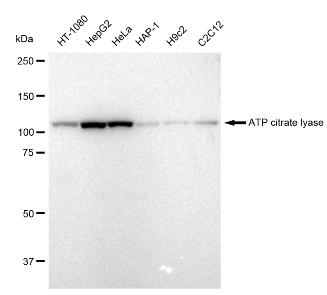 [KD Validated] Anti-ACLY Rabbit mAb [75C11C87]