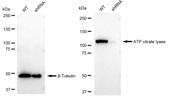 [KD Validated] Anti-ACLY Rabbit mAb [75C11C87]