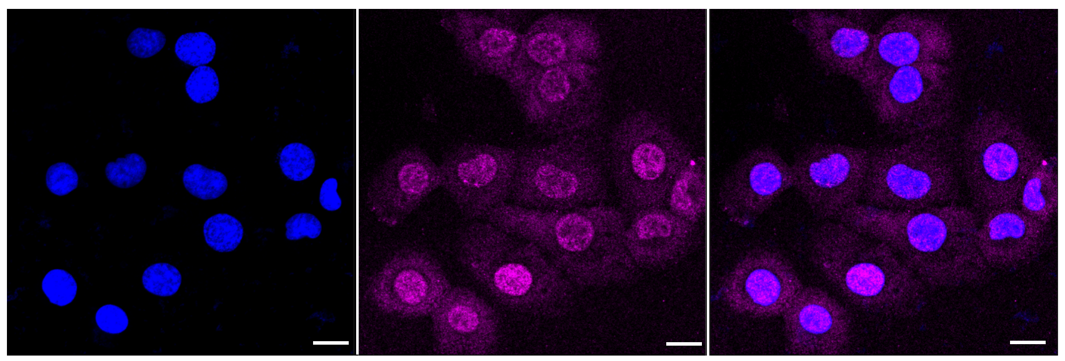 [KD Validated] Anti-GSK3B Rabbit mAb [28C53E23]