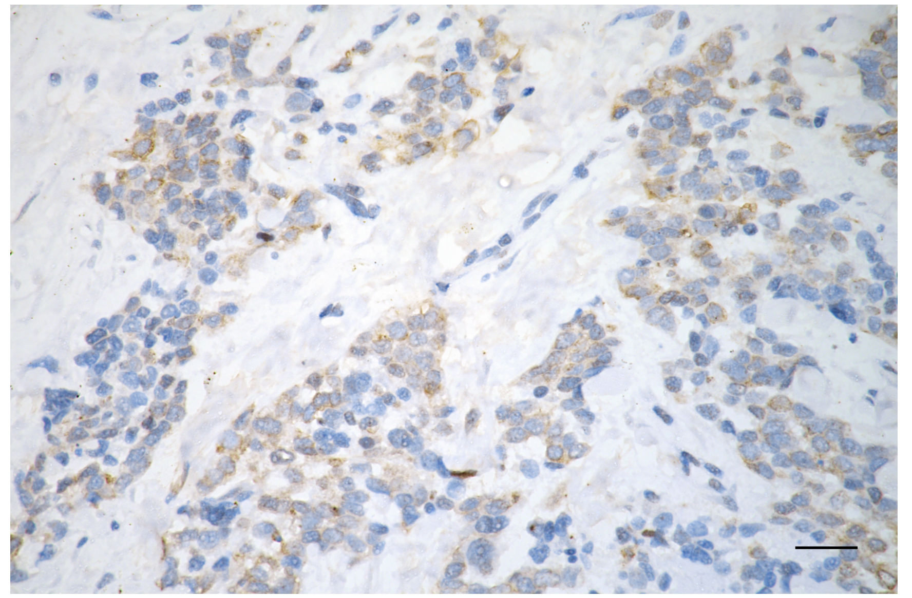 [KD Validated] Anti-GSK3B Rabbit mAb [28C53E23]