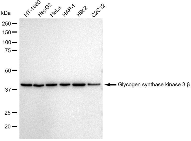 [KD Validated] Anti-GSK3B Rabbit mAb [28C53E23]