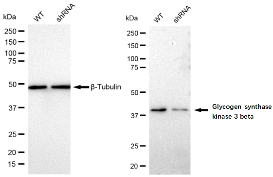 [KD Validated] Anti-GSK3B Rabbit mAb [28C53E23]