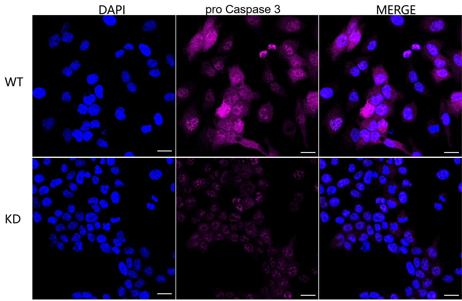[KD Validated] Anti-CASP3 Rabbit mAb [44L99K32]