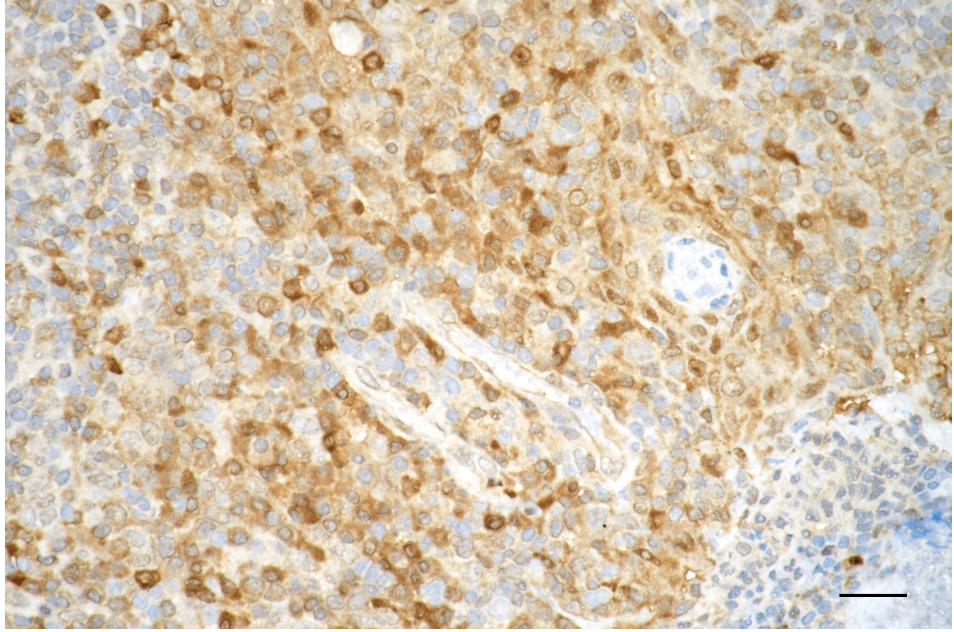 [KD Validated] Anti-CASP3 Rabbit mAb [44L99K32]