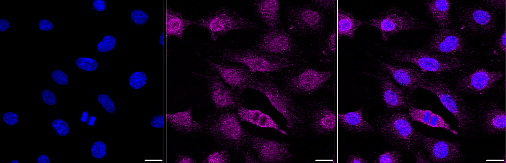 [KD Validated] Anti-SMAD4 Rabbit mAb [40F67E78]