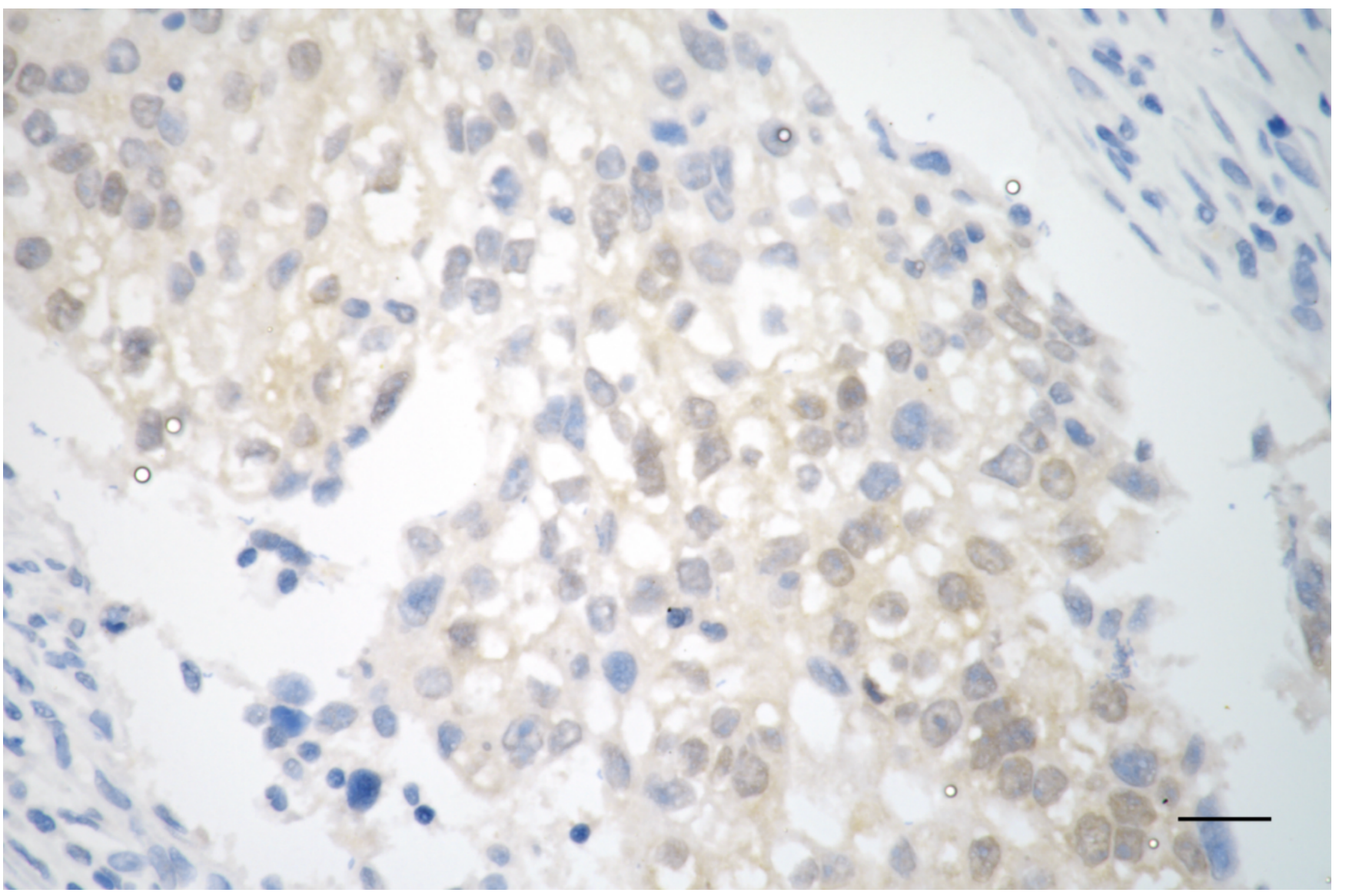 [KD Validated] Anti-SMAD4 Rabbit mAb [40F67E78]