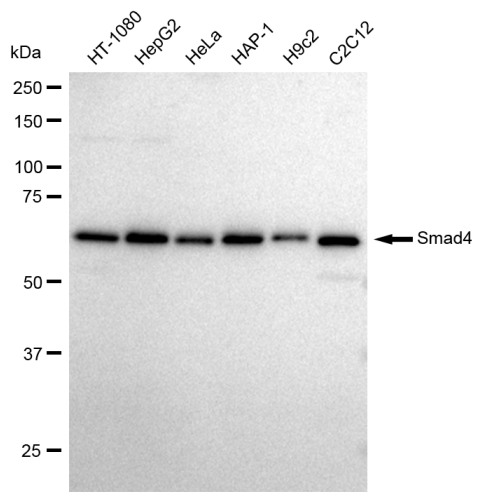 [KD Validated] Anti-SMAD4 Rabbit mAb [40F67E78]