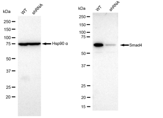 [KD Validated] Anti-SMAD4 Rabbit mAb [40F67E78]