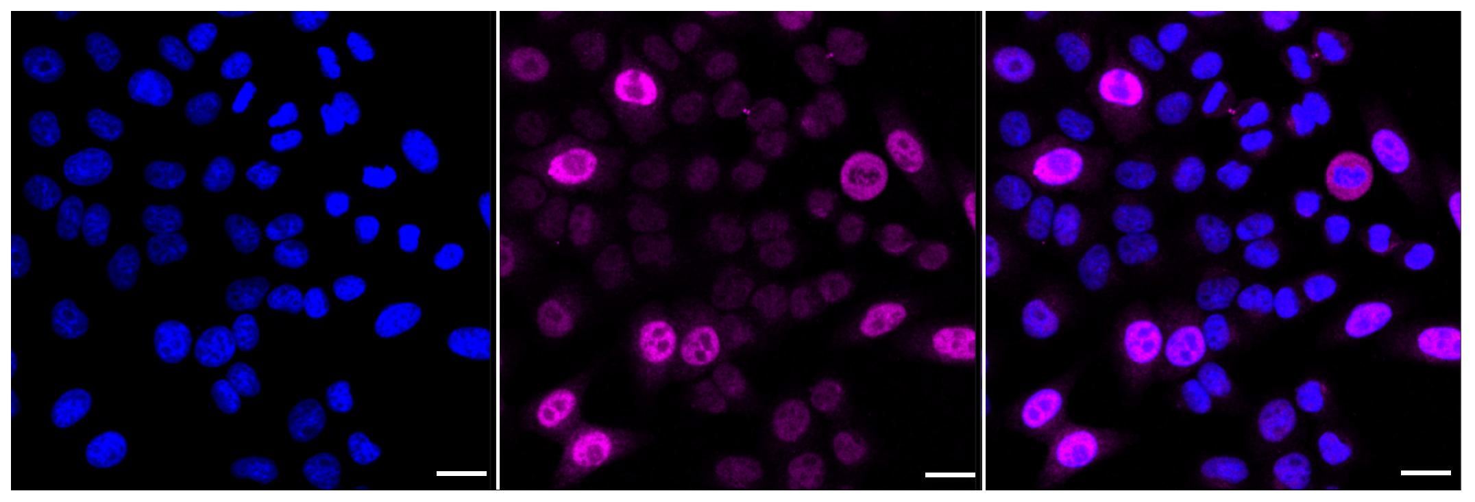 [KD Validated] Anti-CCNA2 Rabbit mAb [47C94Q74]