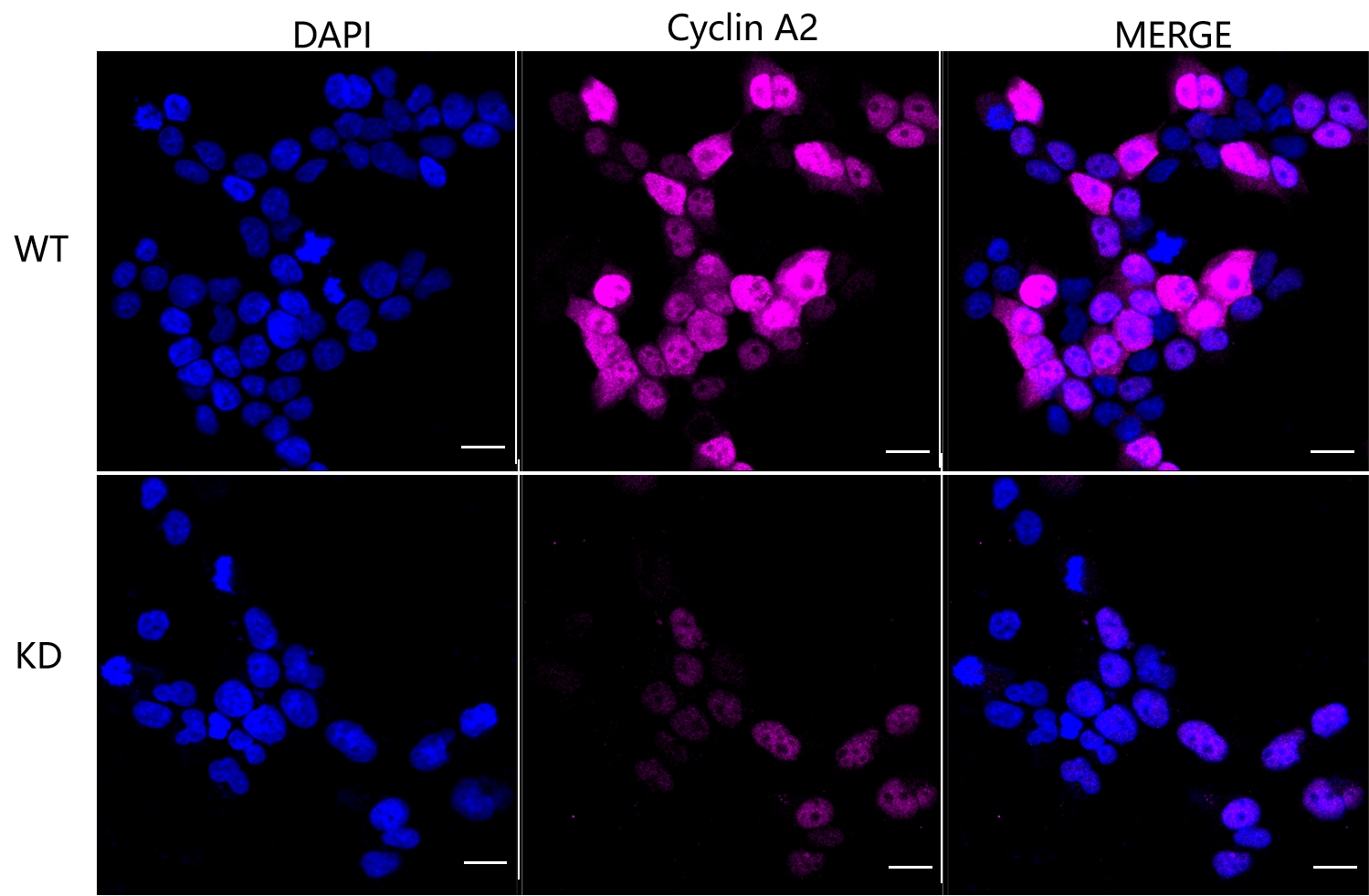[KD Validated] Anti-CCNA2 Rabbit mAb [47C94Q74]