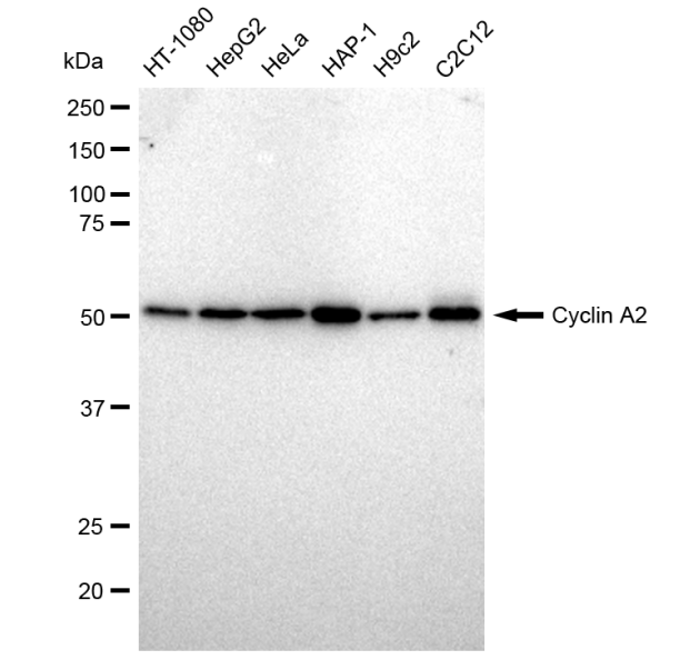 [KD Validated] Anti-CCNA2 Rabbit mAb [47C94Q74]