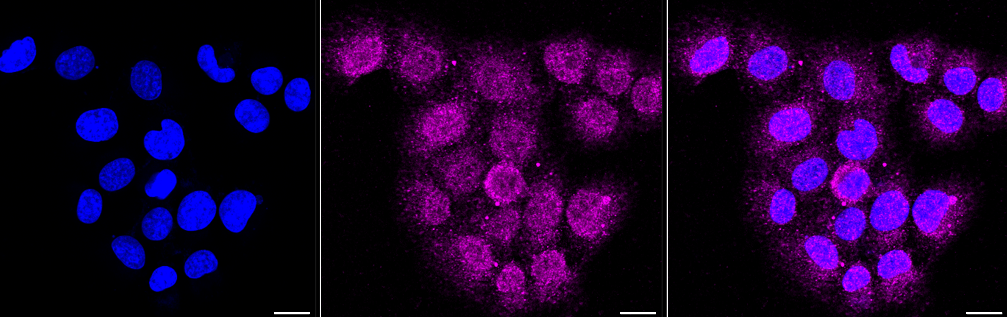 [KD Validated] Anti-ITGB1 Rabbit mAb [32D38S60]