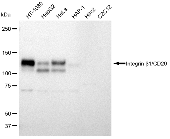 [KD Validated] Anti-ITGB1 Rabbit mAb [32D38S60]