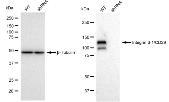[KD Validated] Anti-ITGB1 Rabbit mAb [32D38S60]