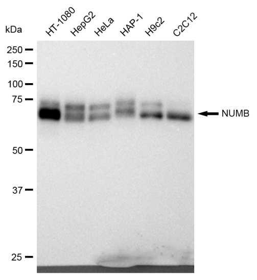 [KD Validated] Anti-NUMB Rabbit mAb [35P50Q18]