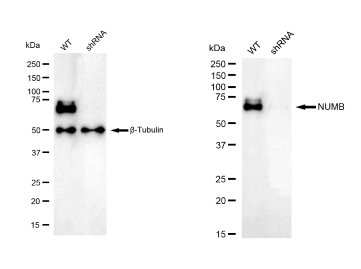 [KD Validated] Anti-NUMB Rabbit mAb [35P50Q18]