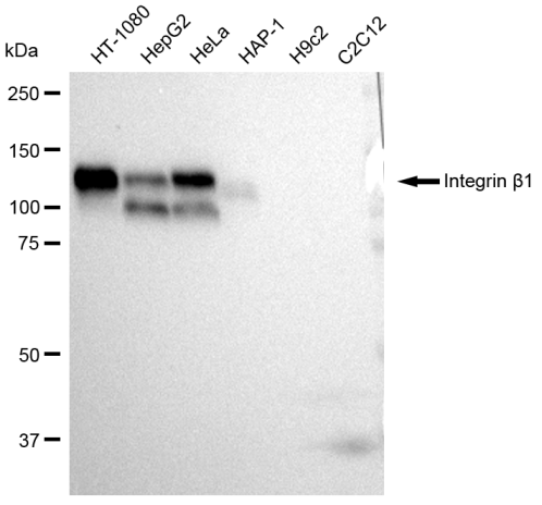 [KD Validated] Anti-ITGB1 Rabbit mAb [34A30Q21]
