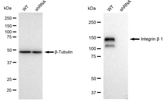 [KD Validated] Anti-ITGB1 Rabbit mAb [34A30Q21]