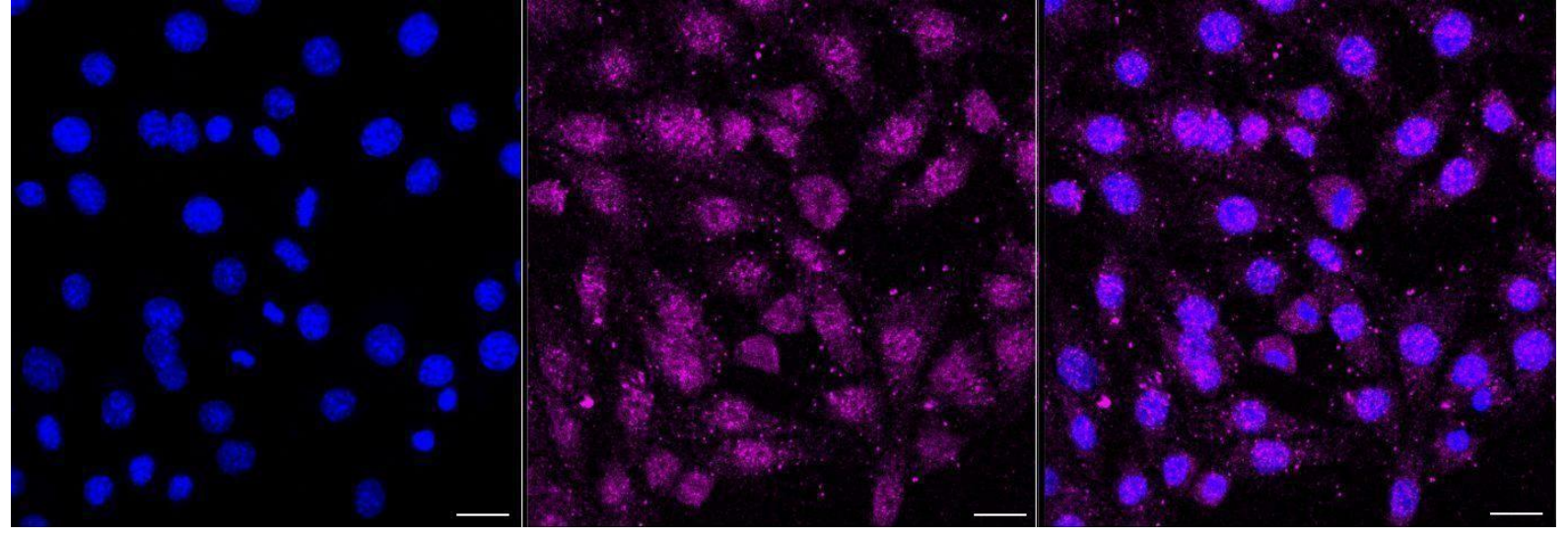 [KD Validated] Anti-CASP3 Rabbit mAb [70F92B28]