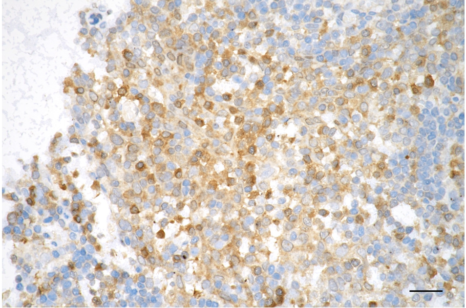 [KD Validated] Anti-CASP3 Rabbit mAb [70F92B28]