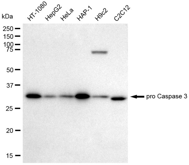 [KD Validated] Anti-CASP3 Rabbit mAb [70F92B28]