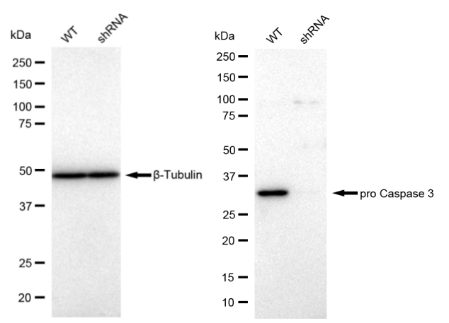 [KD Validated] Anti-CASP3 Rabbit mAb [70F92B28]