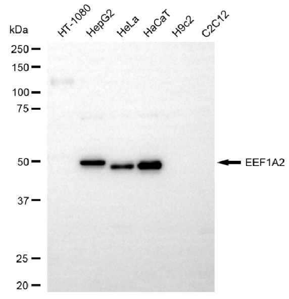 [KD Validated] Anti-EEF1A2 Rabbit mAb [40D44E33]