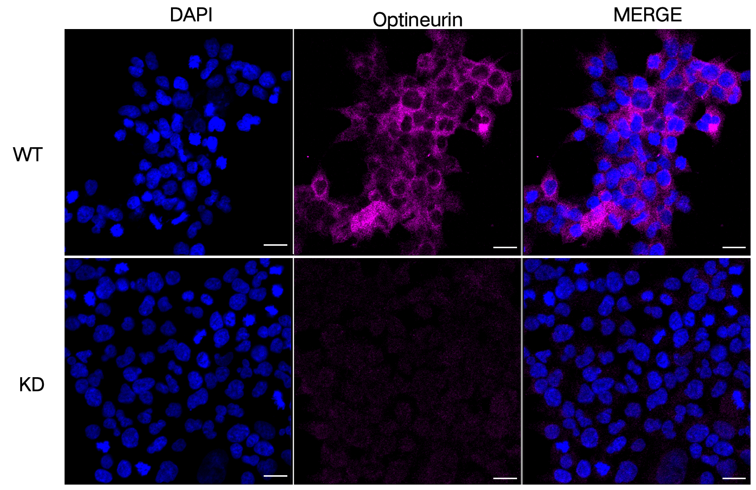 [KD Validated] Anti-OPTN Rabbit mAb [83S59L41]