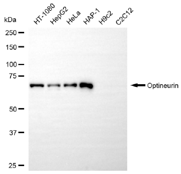 [KD Validated] Anti-OPTN Rabbit mAb [83S59L41]