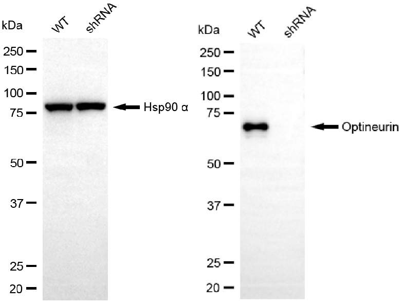 [KD Validated] Anti-OPTN Rabbit mAb [83S59L41]