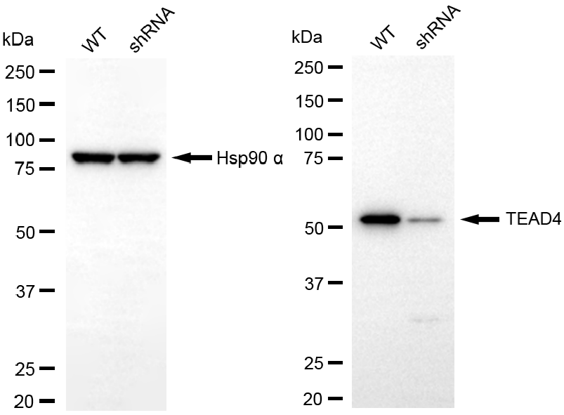 [KD Validated] Anti-TEAD4 Rabbit mAb [77D69E94]