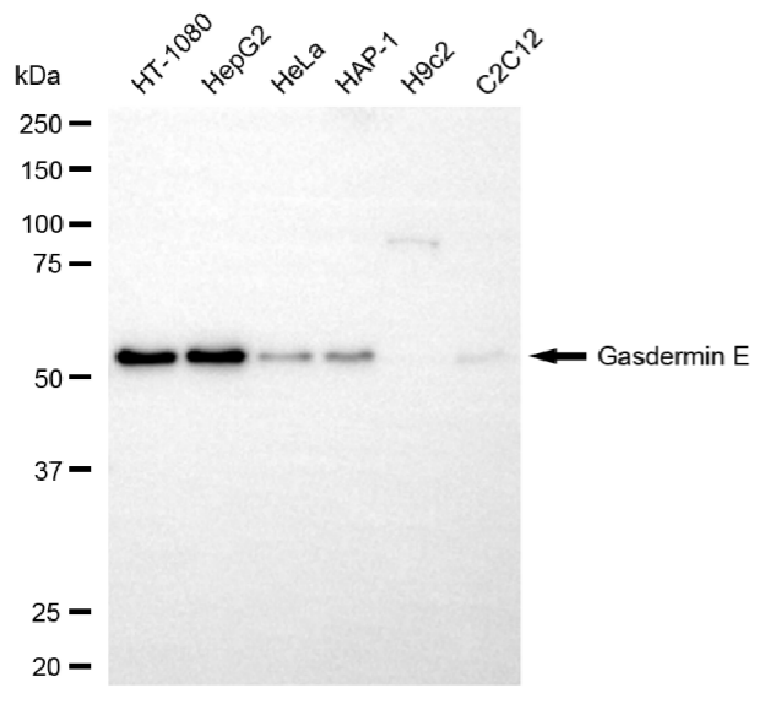 [KD Validated] Anti-GSDME Rabbit mAb [25L82A81]