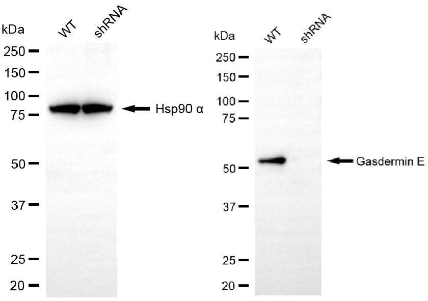 [KD Validated] Anti-GSDME Rabbit mAb [25L82A81]