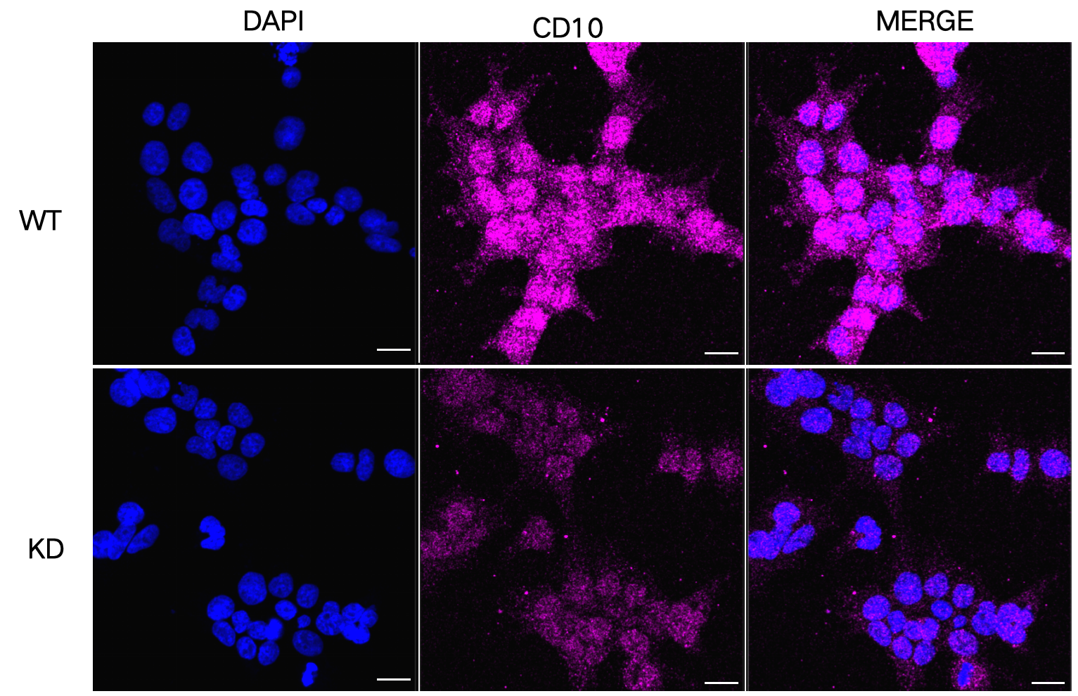 [KD Validated] Anti-PIP5K1C Rabbit mAb [30Q95L94]