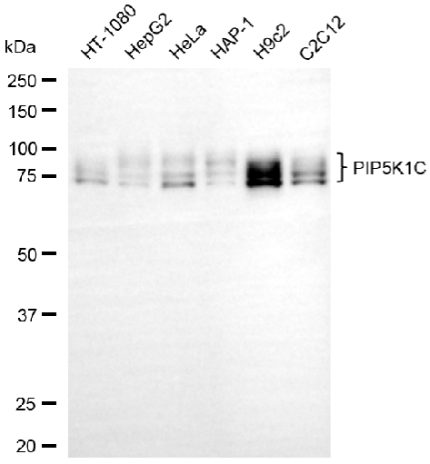 [KD Validated] Anti-PIP5K1C Rabbit mAb [30Q95L94]