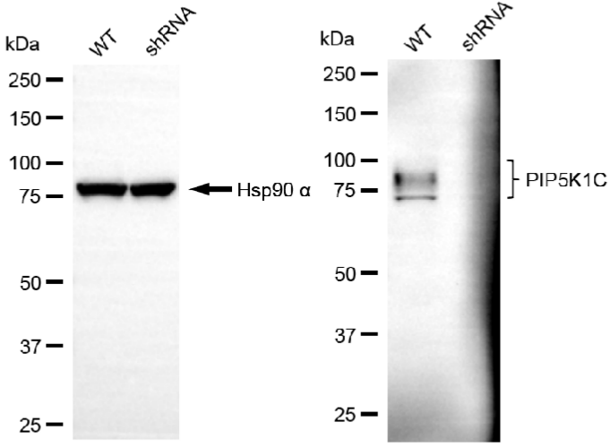 [KD Validated] Anti-PIP5K1C Rabbit mAb [30Q95L94]