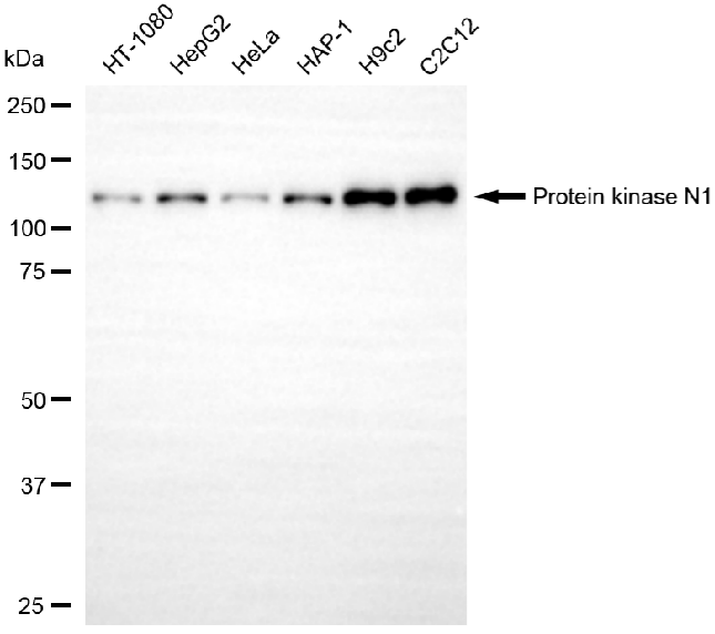 [KD Validated] Anti-PKN1 Rabbit mAb [81M97K23]