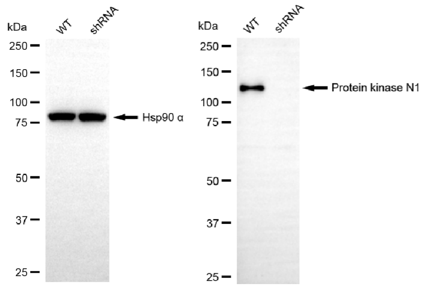 [KD Validated] Anti-PKN1 Rabbit mAb [81M97K23]