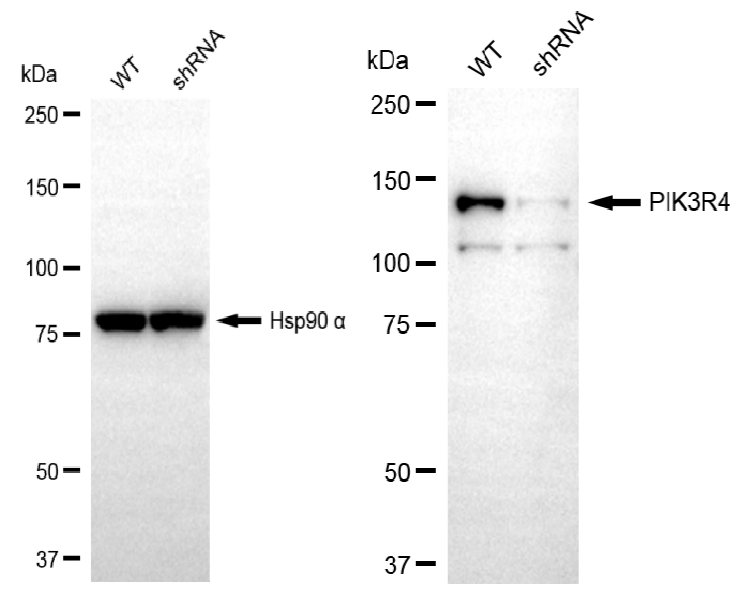 [KD Validated] Anti-PIK3R4 Rabbit mAb [75B09R38]