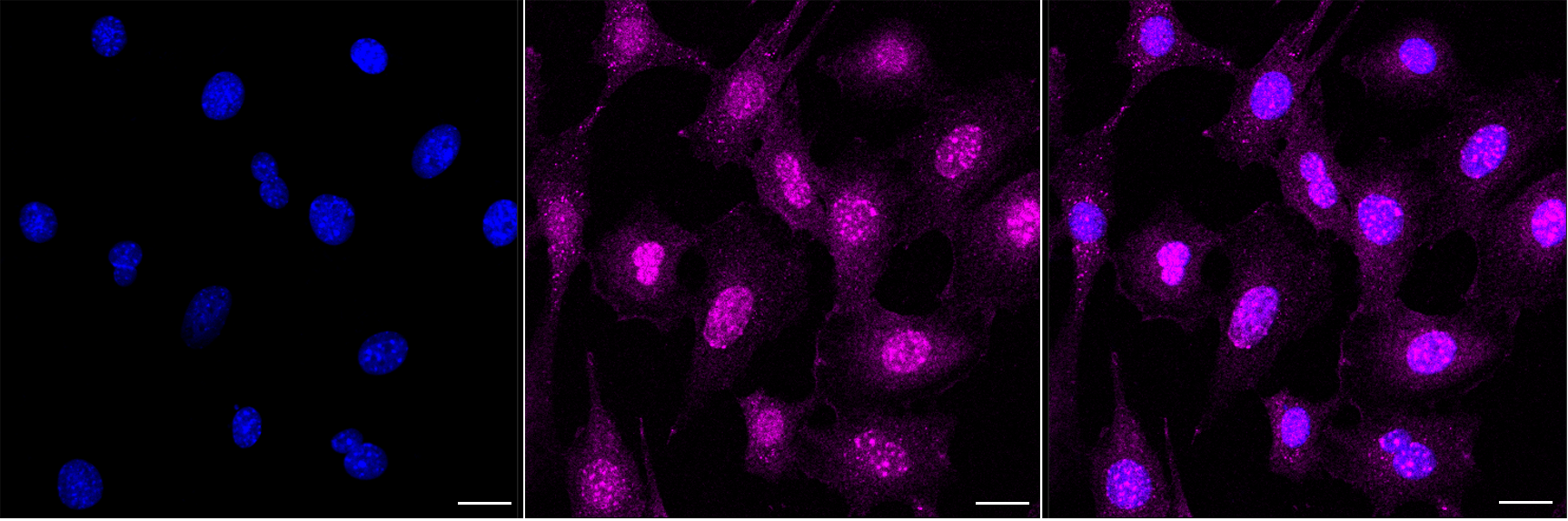 [KD Validated] Anti-CSNK1A1 Rabbit mAb [97R45O53]