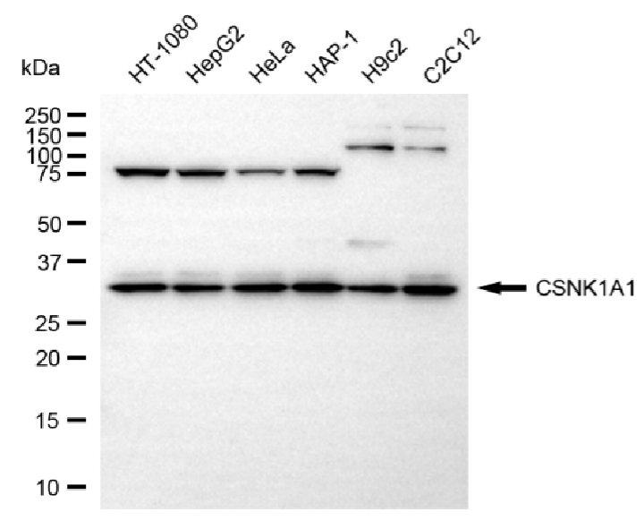 [KD Validated] Anti-CSNK1A1 Rabbit mAb [97R45O53]