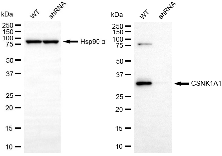 [KD Validated] Anti-CSNK1A1 Rabbit mAb [97R45O53]