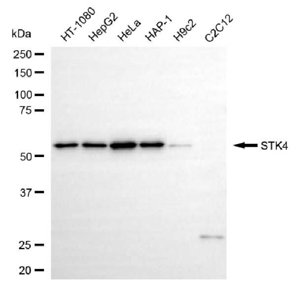 [KD Validated] Anti-STK4 Rabbit mAb [43M50R67]