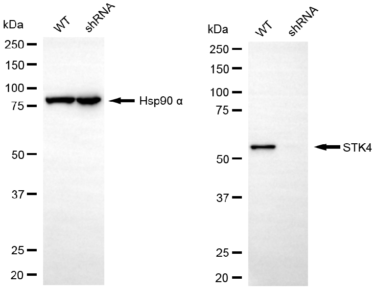 [KD Validated] Anti-STK4 Rabbit mAb [43M50R67]