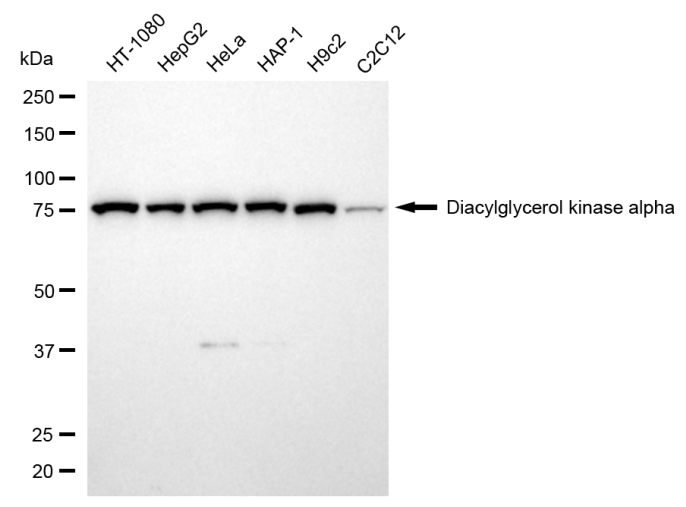 [KD Validated] Anti-DGKA Rabbit mAb [60N96D52]