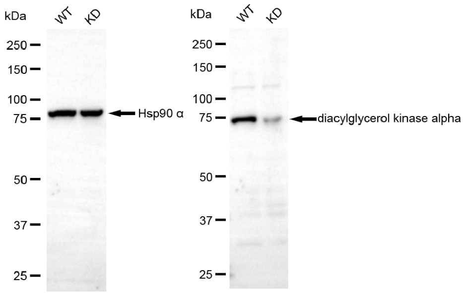 [KD Validated] Anti-DGKA Rabbit mAb [60N96D52]