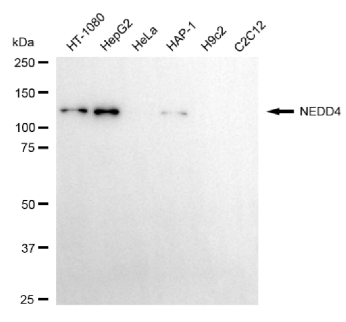 [KD Validated] Anti-NEDD4 Rabbit mAb [66F85A89]