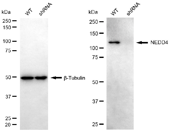 [KD Validated] Anti-NEDD4 Rabbit mAb [66F85A89]