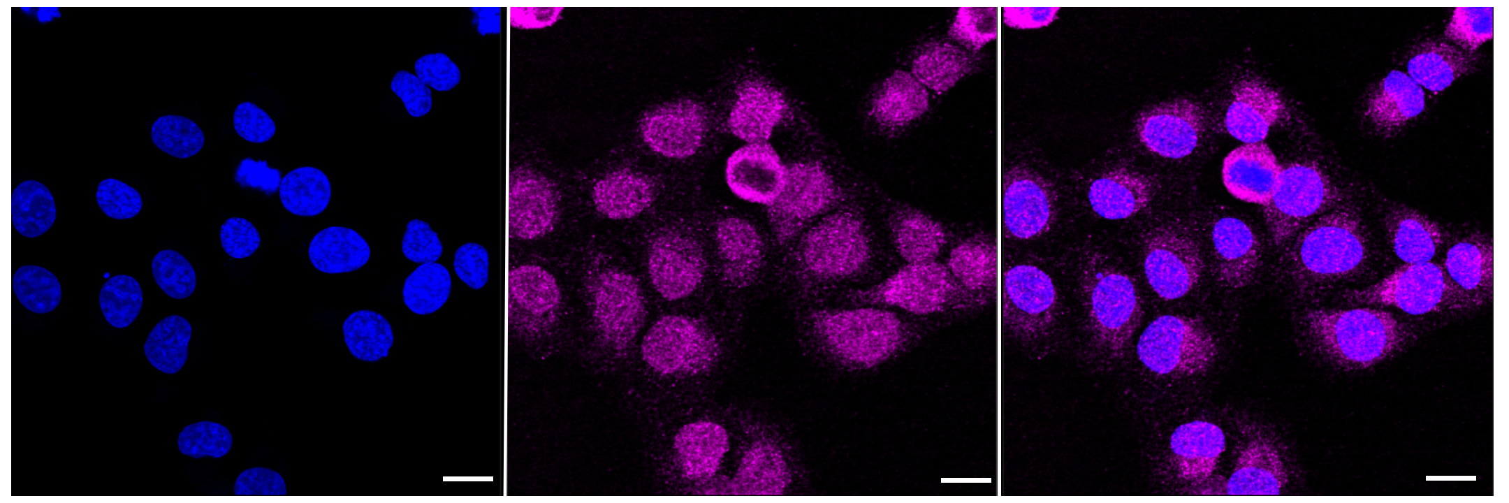 [KD Validated] Anti-ITGB1 Rabbit mAb [72A37B80]