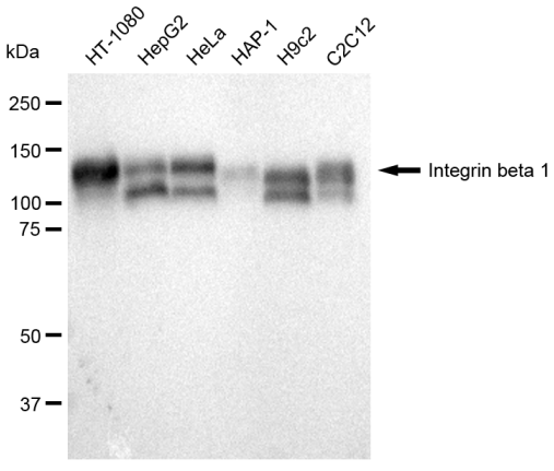[KD Validated] Anti-ITGB1 Rabbit mAb [72A37B80]